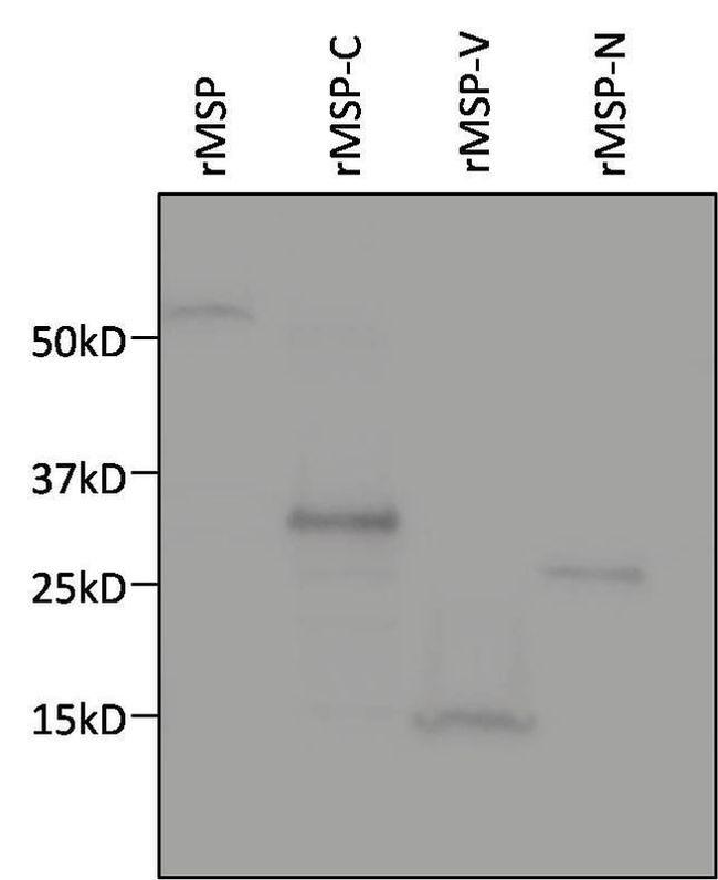 6x-His Tag Antibody in Western Blot (WB)