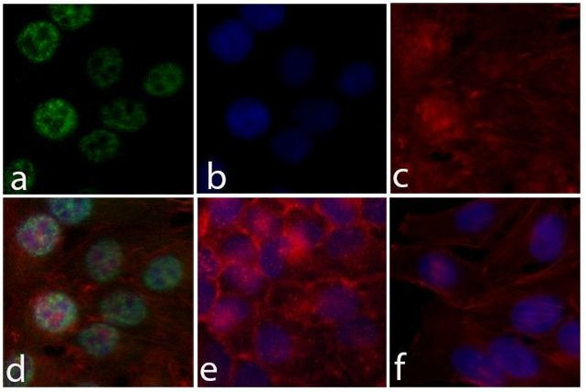 Phospho-ERK1/ERK2 (Thr185, Tyr187) Antibody in Immunocytochemistry (ICC/IF)