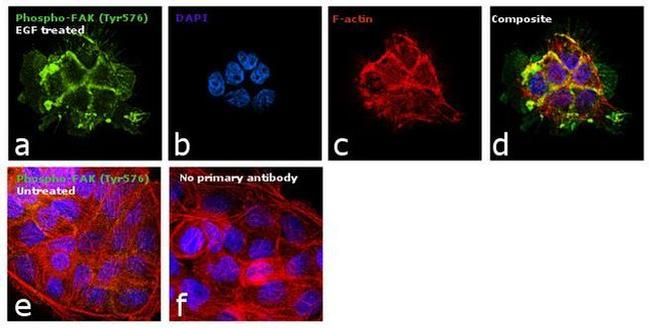 Phospho-FAK (Tyr576) Antibody