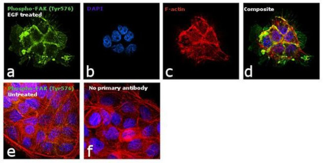 Phospho-FAK (Tyr576) Antibody in Immunocytochemistry (ICC/IF)