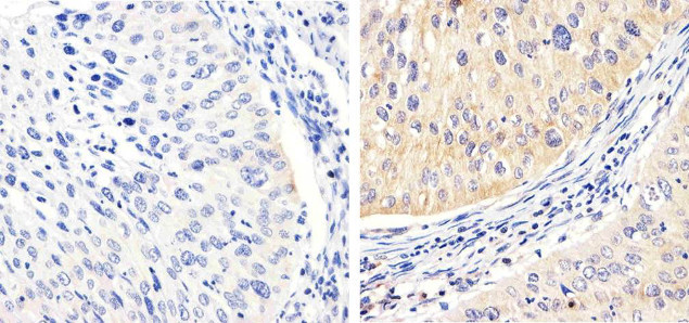 Phospho-FAK (Tyr576) Antibody in Immunohistochemistry (Paraffin) (IHC (P))