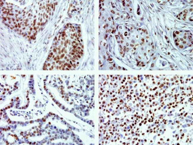 Phospho-JNK1/JNK2 (Thr183, Tyr185) Antibody in Immunohistochemistry (Paraffin) (IHC (P))