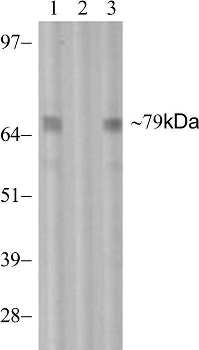 Phospho-PKC theta (Thr538) Antibody in Western Blot (WB)
