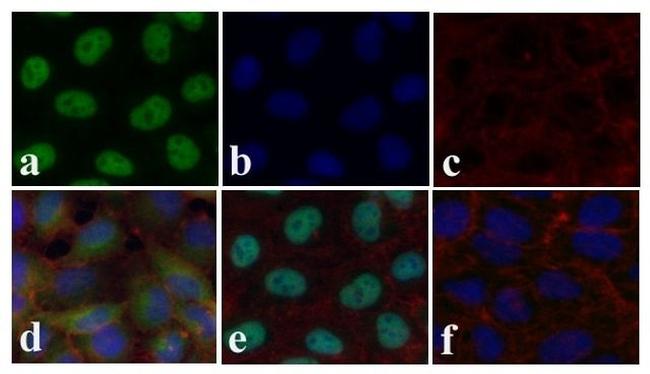 SMAD2 Antibody