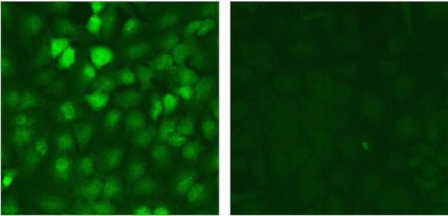 SMAD2 Antibody in Immunocytochemistry (ICC/IF)