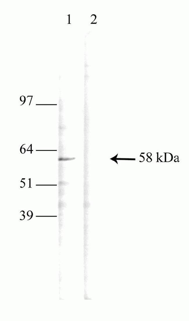 T-bet Antibody in Western Blot (WB)