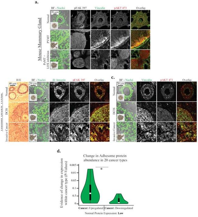 Vinculin Antibody in Immunohistochemistry (IHC)