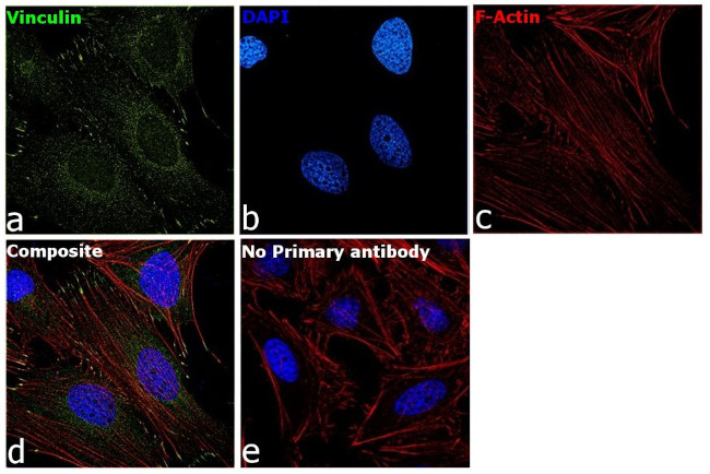 Vinculin Antibody in Immunocytochemistry (ICC/IF)