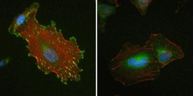 Vinculin Antibody in Immunocytochemistry (ICC/IF)