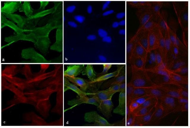 Vinculin Antibody in Immunocytochemistry (ICC/IF)