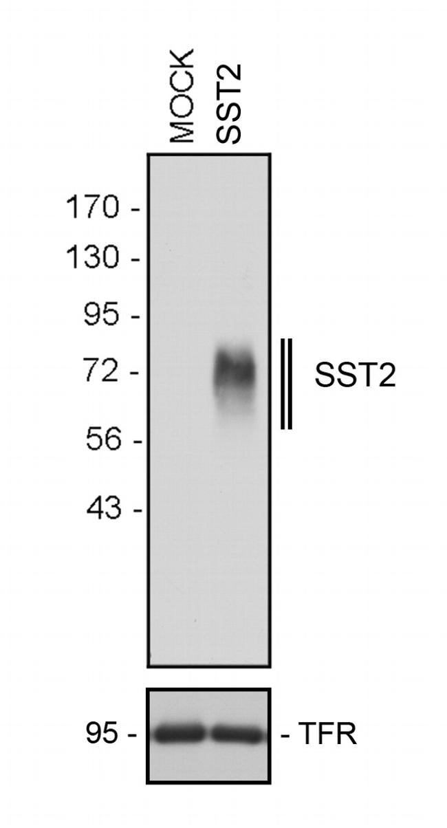 SSTR2 Antibody in Western Blot (WB)