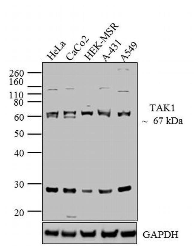 TAK1 Antibody in Western Blot (WB)