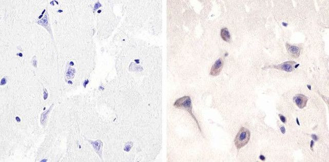 TRAF3 Antibody in Immunohistochemistry (Paraffin) (IHC (P))