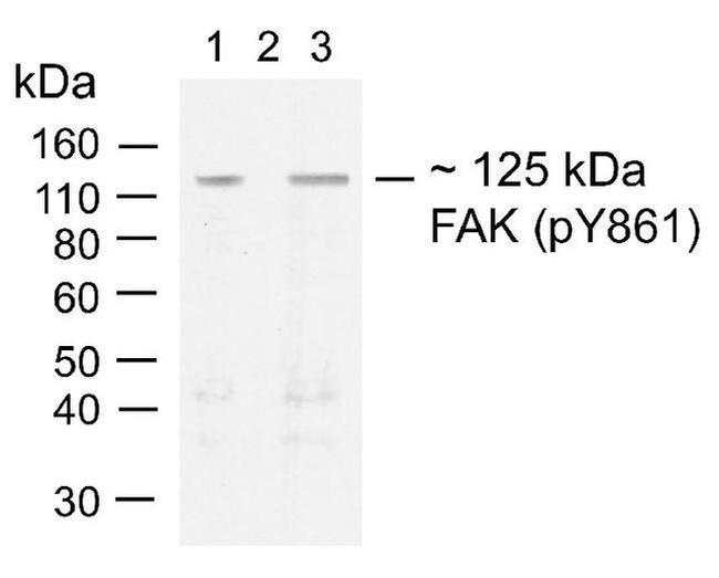 Phospho-FAK (Tyr861) Antibody in Western Blot (WB)