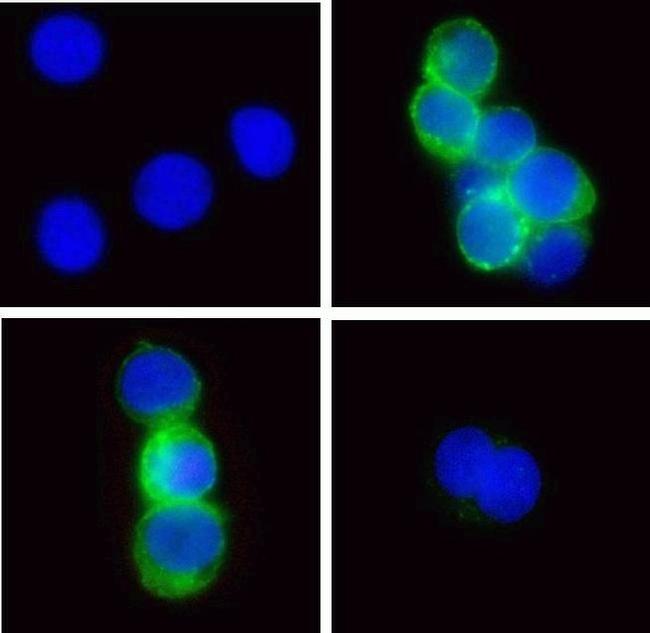 Phospho-Zap-70 (Tyr315, Tyr319) Antibody