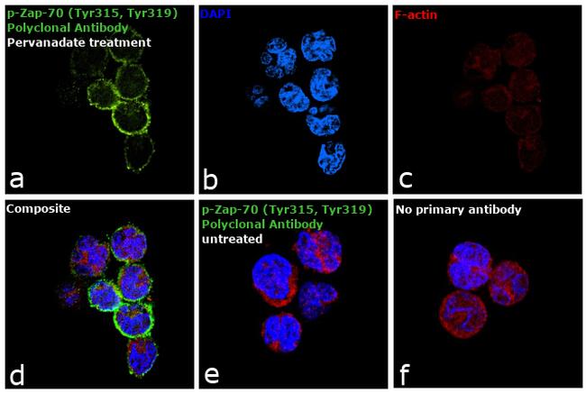 Phospho-Zap-70 (Tyr315, Tyr319) Antibody