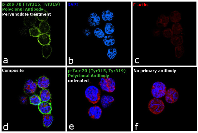 Phospho-Zap-70 (Tyr315, Tyr319) Antibody in Immunocytochemistry (ICC/IF)