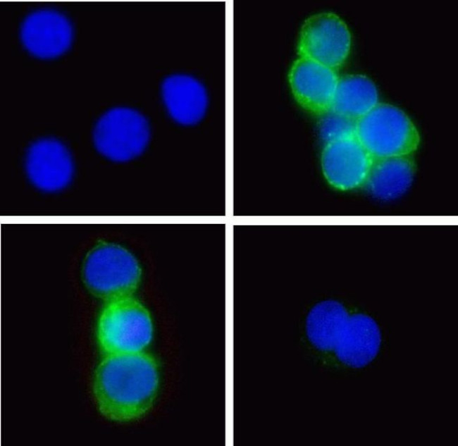 Phospho-Zap-70 (Tyr315, Tyr319) Antibody in Immunocytochemistry (ICC/IF)