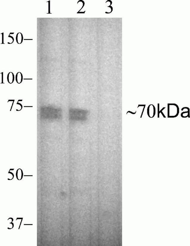 Phospho-Zap-70 (Tyr315, Tyr319) Antibody in Western Blot (WB)