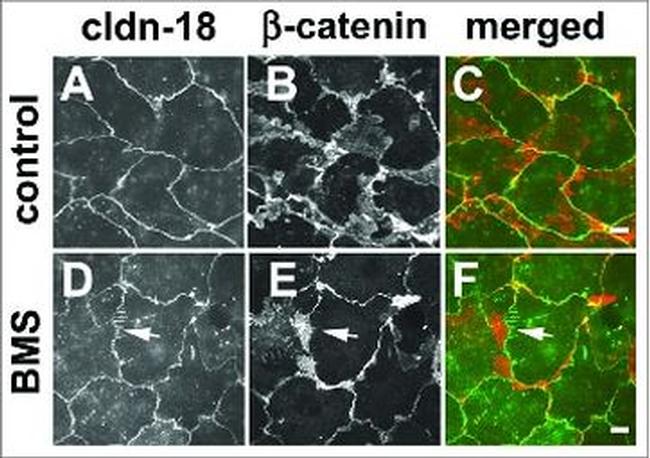 Claudin 18 Antibody in Immunocytochemistry (ICC/IF)