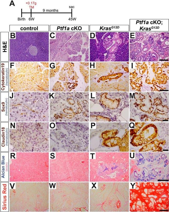 Claudin 18 Antibody in Immunohistochemistry (Paraffin) (IHC (P))