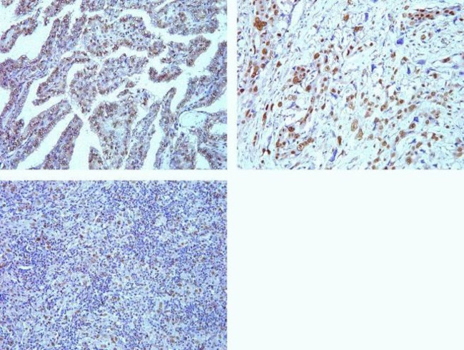 PSME3 Antibody in Immunohistochemistry (Paraffin) (IHC (P))