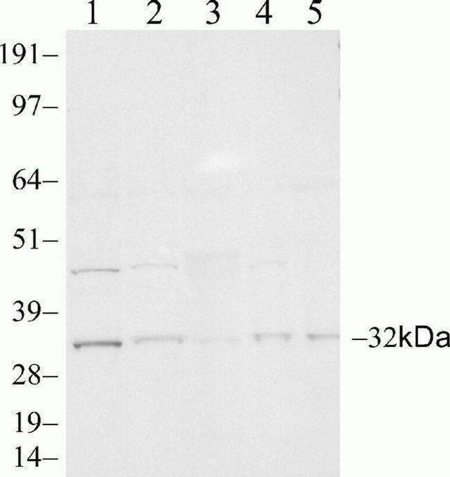 PSME3 Antibody in Western Blot (WB)