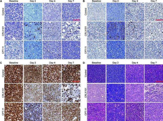 Caspase 3 Antibody in Immunohistochemistry (Paraffin) (IHC (P))