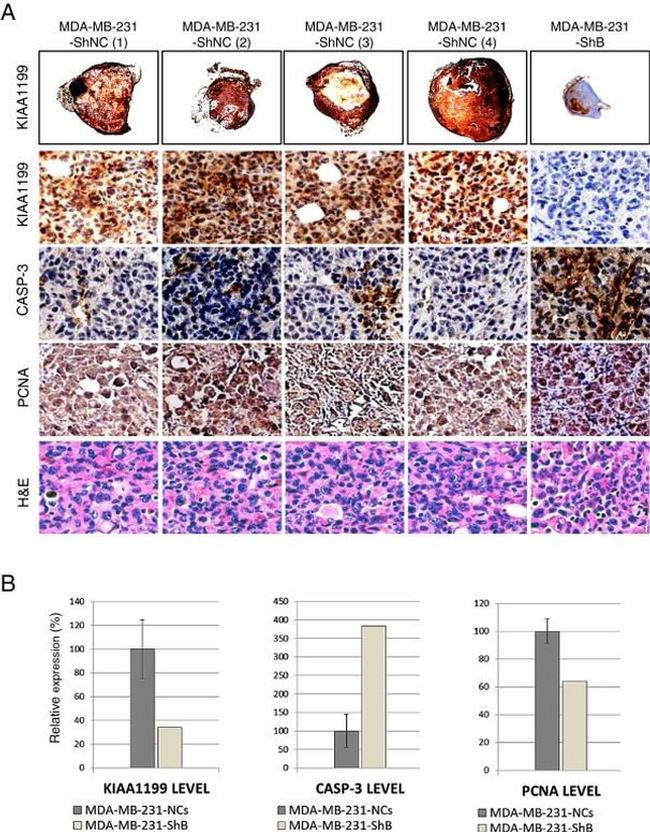 Caspase 3 Antibody in Immunohistochemistry (IHC)