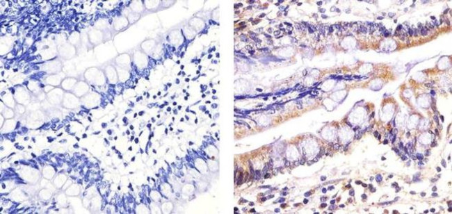 Caspase 3 Antibody in Immunohistochemistry (Paraffin) (IHC (P))