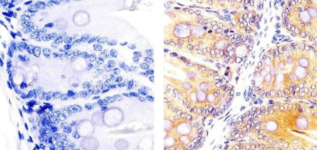 Caspase 3 Antibody in Immunohistochemistry (Paraffin) (IHC (P))