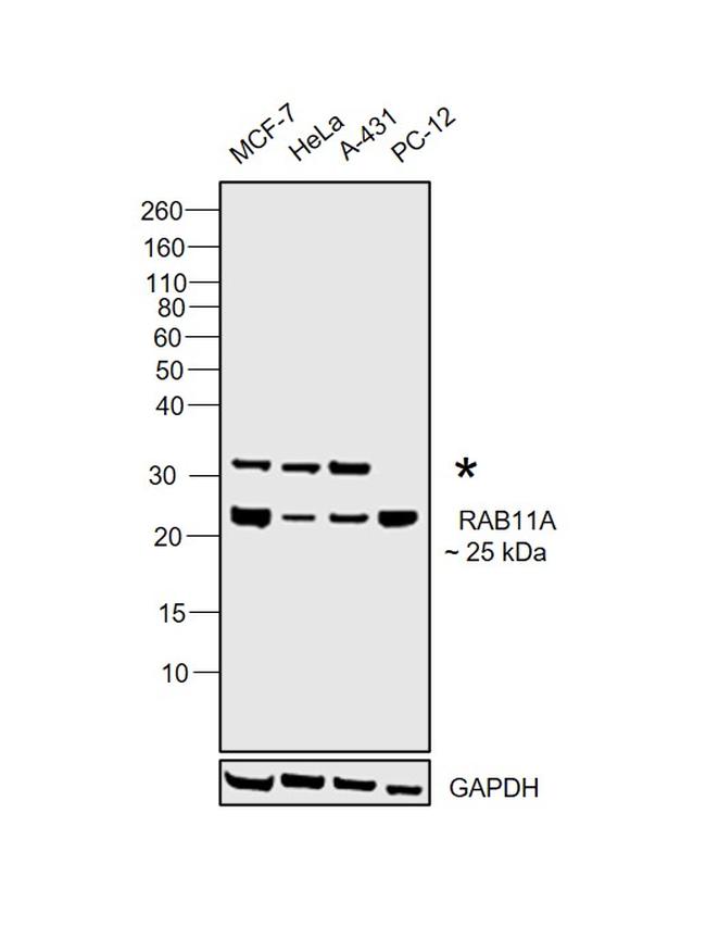 RAB11A Antibody in Western Blot (WB)