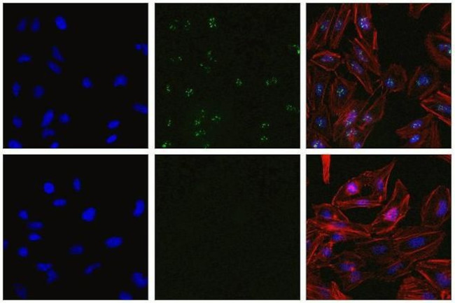 RAB11A Antibody in Immunocytochemistry (ICC/IF)