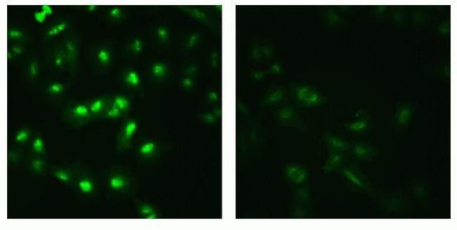 STAT4 Antibody in Immunocytochemistry (ICC/IF)