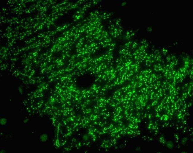 Afadin Antibody in Immunohistochemistry (Paraffin) (IHC (P))