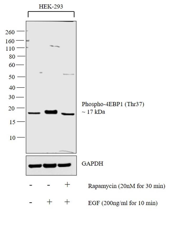 Phospho-4EBP1 (Thr37) Antibody