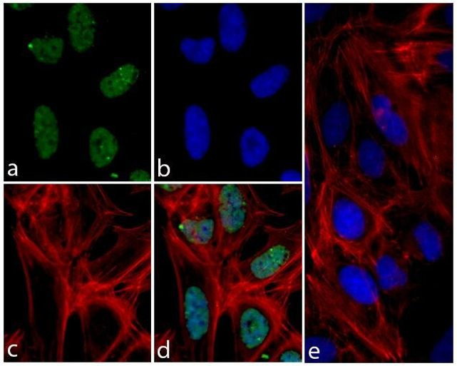 Phospho-4EBP1 (Thr37) Antibody in Immunocytochemistry (ICC/IF)