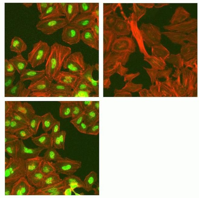 Phospho-4EBP1 (Thr37) Antibody in Immunocytochemistry (ICC/IF)