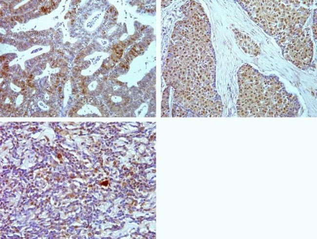 Phospho-4EBP1 (Thr37) Antibody in Immunohistochemistry (Paraffin) (IHC (P))