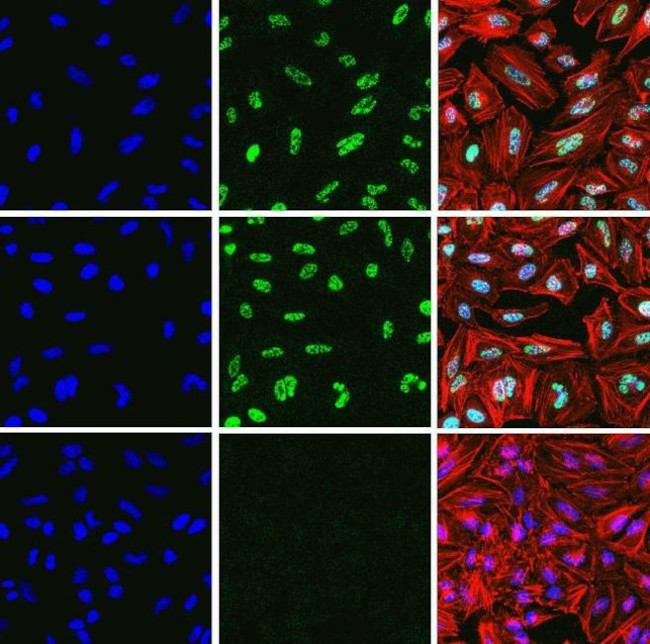 Phospho-MNK1 (Thr197, Thr202) Antibody in Immunocytochemistry (ICC/IF)