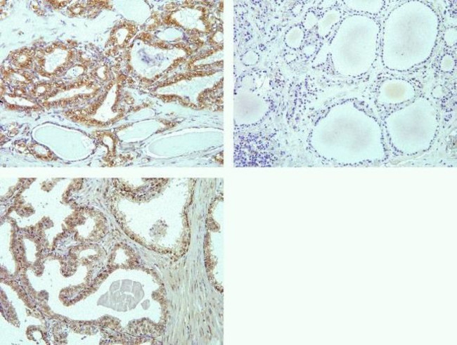 Phospho-MNK1 (Thr197, Thr202) Antibody in Immunohistochemistry (Paraffin) (IHC (P))