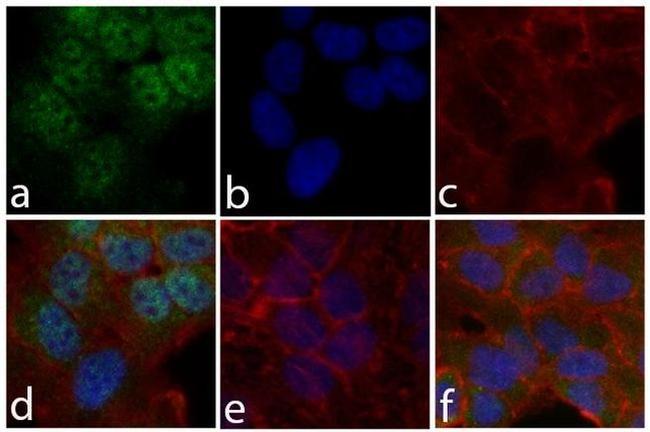 Phospho-STAT6 (Tyr641) Antibody