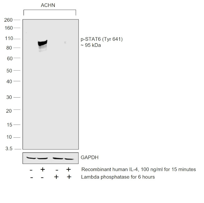 Phospho-STAT6 (Tyr641) Antibody