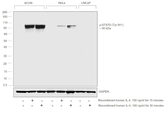 Phospho-STAT6 (Tyr641) Antibody in Western Blot (WB)