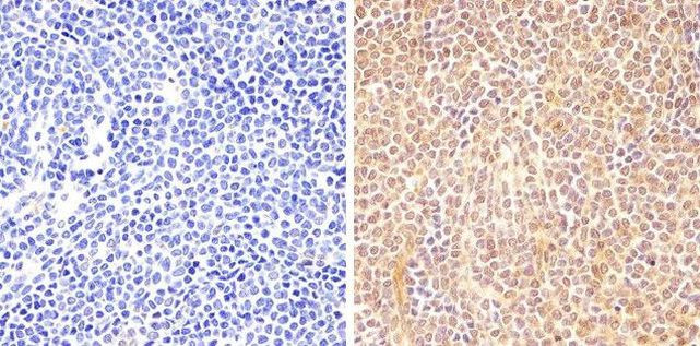 Phospho-STAT6 (Tyr641) Antibody in Immunohistochemistry (Paraffin) (IHC (P))