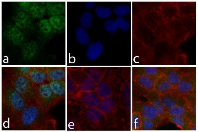 Phospho-STAT6 (Tyr641) Antibody in Immunocytochemistry (ICC/IF)