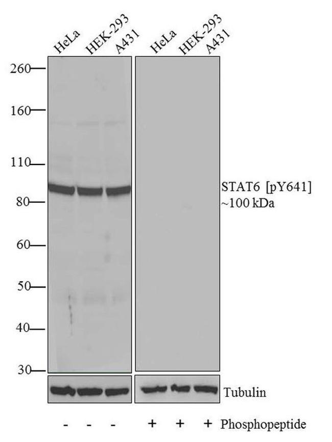 Phospho-STAT6 (Tyr641) Antibody in Western Blot (WB)