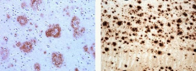 beta Amyloid Antibody in Immunohistochemistry (Paraffin) (IHC (P))