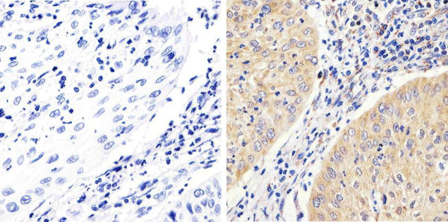 Phospho-FAK (Tyr397) Antibody in Immunohistochemistry (Paraffin) (IHC (P))