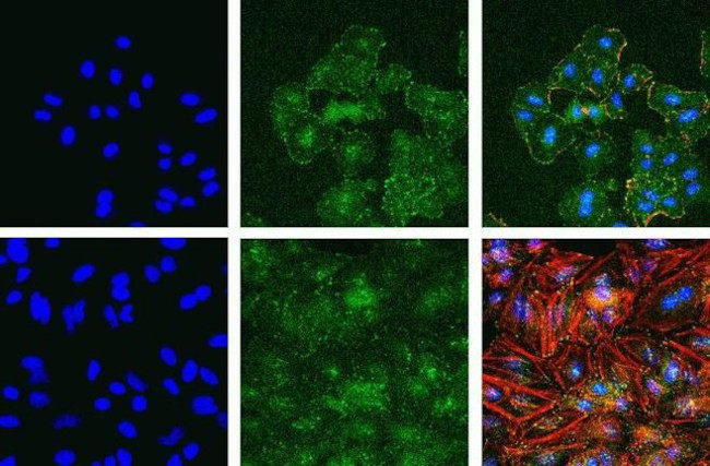 Phospho-FAK (Tyr397) Antibody in Immunocytochemistry (ICC/IF)